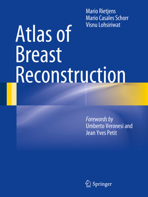 cover image of Atlas of Breast Reconstruction